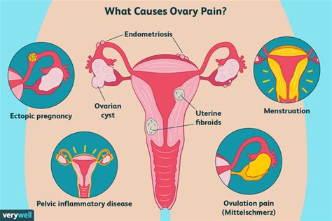 Woke up with a pain in overt area do I need to see doctor.